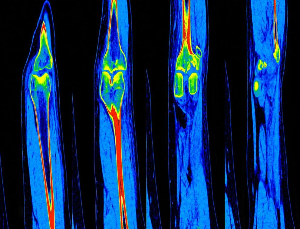 A close-up of several blue and red x-ray images
