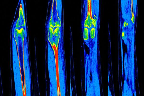 A close-up of several blue and red x-ray images